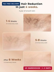 Ubroo Laser Hair Removal with 5℃ Ice Cooling,Hand-held Hair Removal Device IPL H