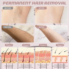 SEJOY Hair Epilator Painless Exfoliation Hair Remover, Shaver, MEN AND WOMAN