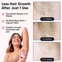 Roseskinco Lumi Ipl Laser Hair Removal Device At Home Permanent Hair Reduction