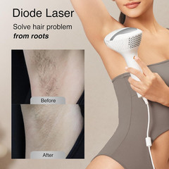 Diode Laser Hair Removal for Men and Women, V8S for Skin Tone 1-5, Permanent Red