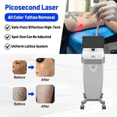 Fractional Laser Co2 Nd Yag Laser Tattoo Remove Facial Skin Rejuvenation Machine