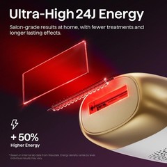 IPL Hair Removal Device – Precision Roller for Face, Body & Bikini – Painless, L
