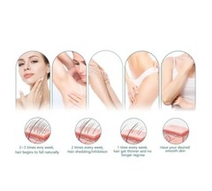 Laser Hair Removal IPL Hair Removal for Women and Men Permanent Painless at-H…