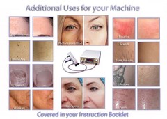 Avance Permanent Hair, Wrinkle, Vein & Tattoo Removal Treatment System & Kit.