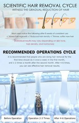 808 Diode Laser Hair Removal Machine 755 808 940 1064nm 10Bars Smooth Skin