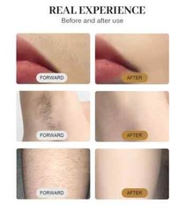 Professional 2026 ICE Titanium 755/808/1064 Diode Laser Hair Removal System
