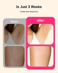 Hair Removal Laser IPL Permanent Epilator Body Painless Device Skin Flashes Leg