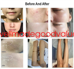 2 in 1 755/808/1064nm Diode Laser Skin Rejuvenation Hair Removal Machine 1200W