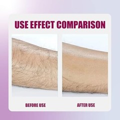 Crystal Hair Eraser Painless Hair Removal with Epilator, Gemstone Blue Free Ship