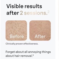 IPL Laser Hair Removal Facial Whole Body Legs Bikini Permanent Remover