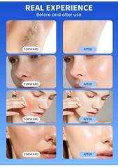 755/1064nm Alexandrite Long-Pulse Fiber Semiconductor Laser Hair Removal Machine