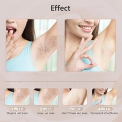 990000 Flashes Electric Depiladora Laser Permanent IPL Laser Hair Removal Device