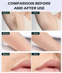 2 In 1 808nm Diode Laser Hair Removal & Pico Laser Tattoo removal Machine 10bar