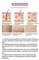 2 In 1 808nm Diode Laser Hair Removal & Nd Yag Pico Laser Tattoo removal Machine