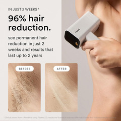 Nood™ NEW Flasher Pro — IPL Laser Hair Removal Device & Anti-Aging Red Light The