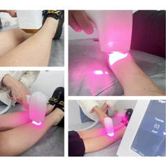 Professional 2026 ICE Titanium 755/808/1064 Diode Laser Hair Removal System