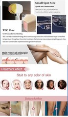 2026 Diode Laser Hair Removal Yag 755 808 1064 Diode Laser Hair Removal Machine