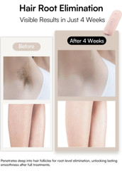 Laser Hair Removal Device for Women and Men, INIA Fond Hair Remover (NEW)