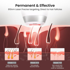 Diode Laser Hair Removal for Men and Women, V8S for Skin Tone 1-5, Permanent Red