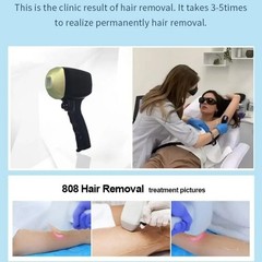 New 2 In1 808nm Diode Laser Nd Yag Laser Pico Laser Tattoo Hair Removal Machine