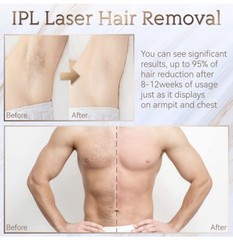 IPL Hair Removal, Laser Permanent Hair Removal for Women and Men, 999900 Flashes