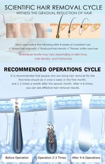 755/808/940/1064nm diode laser hair removal machine, suitable for salons, 4000w