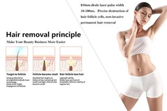 Portable 810NM Diode Laser Hair Removal Machine 3 Waves 755/1064/808nm Diode