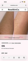 RoseSkinCo. Lumi IPL Hair Removal Device, Pink, FDA Cleared, Legs Arms Bikini