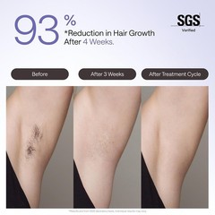 Air 4 IPL Laser Hair Removal Device: Clinically Proven for Permanent Smoothness
