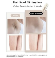 INIA Fond Unisex Laser Hair Removal Device For Face, Body, Armpits & Legs D-1198