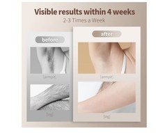 Laser Hair Removal, Rose gold Unlim Flashes IPL Permanent Hair Removal Sealed