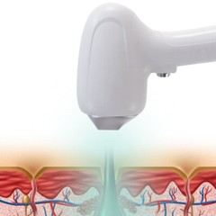 Painless Diode Laser 808nm Hair Removal Whitening Skin Rejuvenation Machine