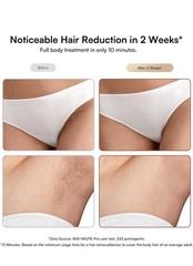At-home IPL Hair Remover for Women/Men Permanent Armpits Back Legs Arms Face