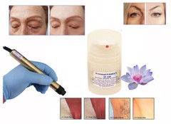 Dermal Plast, Helps to reduce the discomfort from laser and IPL treatments.