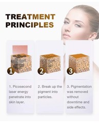 2 in 1 diode hair removal Picosecond device ice cooling system tattoo removal