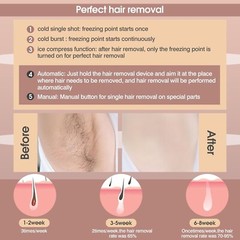 Hair Removal with Ice-Cooling System, Hair Removal for Women and Men, Painless P