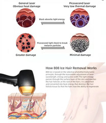 2IN1 755nm 808nm 1064nm Diode Laser Hair Removal Pico Tattoo IPL NG YAG Machine