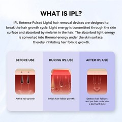 MLAY IPL 17J High Energy Hair Remova Device Ice-Cooling System 5 Energy Levels