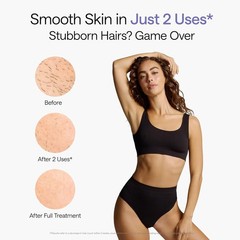 Air 10 IPL Laser Hair Removal Device for Home Use