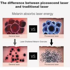 2-In-1 Picosecond 808 Diode Laser Machine for Hair Removal Tattoo Removal Skin