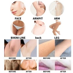 755nm+808nm+1064nm 2IN1 Diode Laser Hair Tattoo Removal Pico Yag Laser Machine