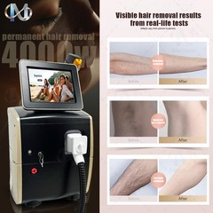 Ice Cooling Diode Laser Painless Whole Body Hair Removal Beauty Equipment