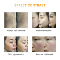 Permanent IPL OPT DPL Laser Hair Removal Machine Acne Vascular Removal Device