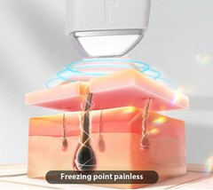 3500W diode laser, 755/808/1064nm wavelength, painless hair removal.
