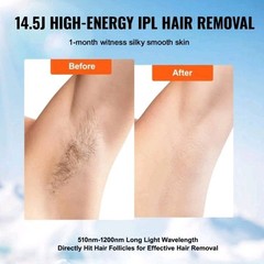VEVOR IPL At Home Hair Removal 5 Level Sapphire Ice Cooling System Smart Sensing