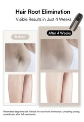 Inia Intense Pulsed Light Hair Removal Device