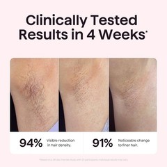 24J Dual-Pulse IPL Hair Removal Device: Fast, Long-lasting Results in 12 Minutes