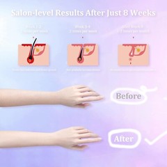 Necool Laser Hair Removal for Women & Men Ipl Hair Removal Device 999,900 Flash