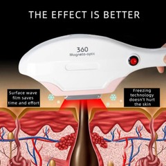 RF IPL OPT Laser Permanent Body Hair Removal Pigment Machine With 6 Wavelenthes