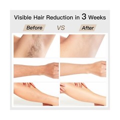 Laser Hair Removal, BoSidin IPL Hair Removal with Painless Ice-Cooling, 2-in-…